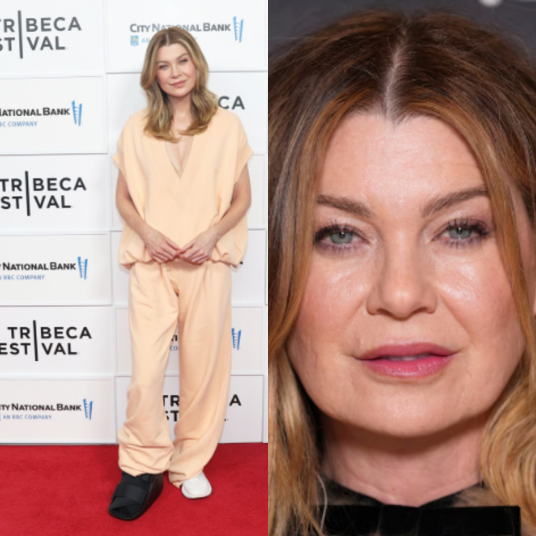 الممثلة الأمريكية إلين بومبيو بطلة مسلسل Grey's Anatomy مربوطة القدم اليمنى بعد إصابتها فيها