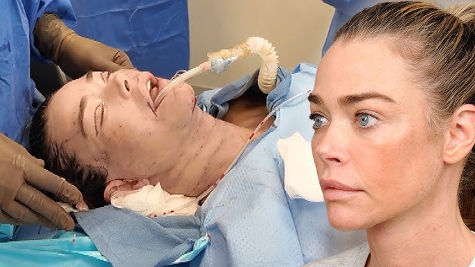 دنيس ريتشاردز أثناء الخضوع لعملية التجميل