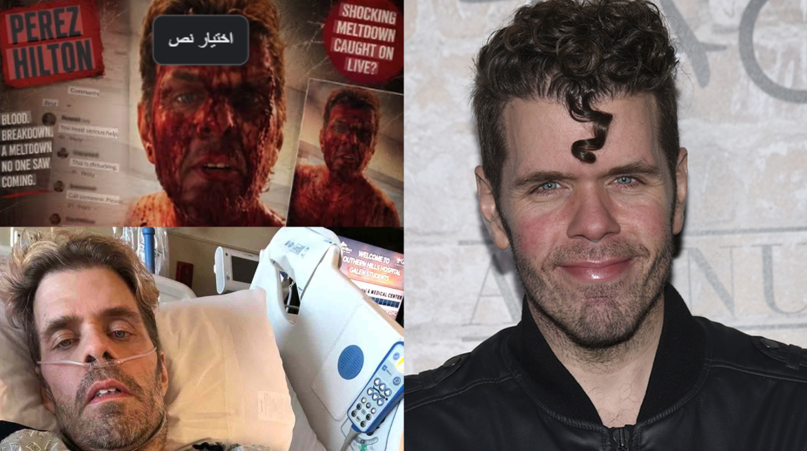 بيريز هيلتون وصورته أثناء إيذاء نفسه وبعد نقله إلى المستشفى