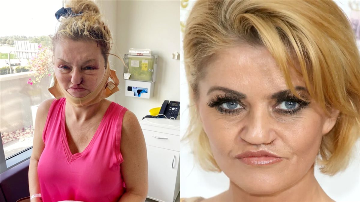 دانييلا وستبروك وصورتها في العمليات الجراحية السابقة