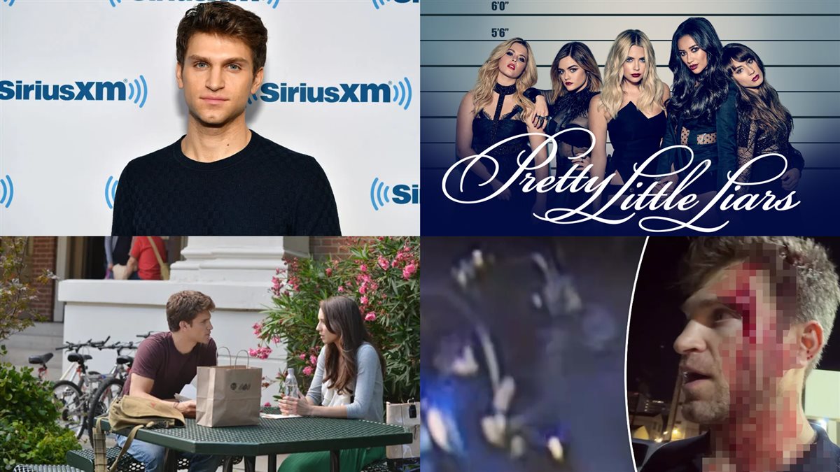 كيجان ألين وصورته ينزف ومشاهد وأفيش مسلسله Pretty Little Liars