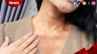 3 وصفات طبيعية فعالة للتخلص من اسمرار الرقبة