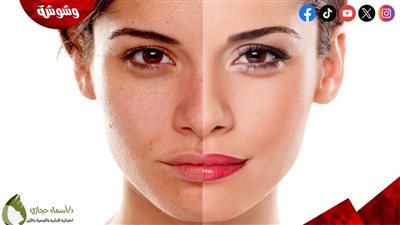 4 علامات تدل على احتياجك لعمل تقشير للبشرة