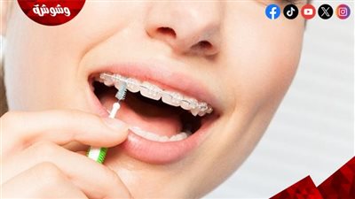 الأسنان السيئة تسرع ظهور مرض السكري