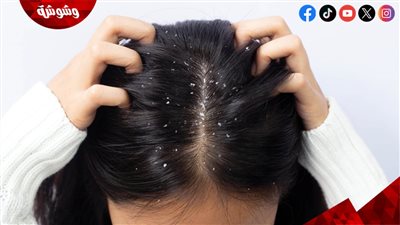 أنواع قشرة البشرة عند النساء