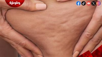 لمعرفة العلاج الصحيح لابد من التشخيص الصحيح