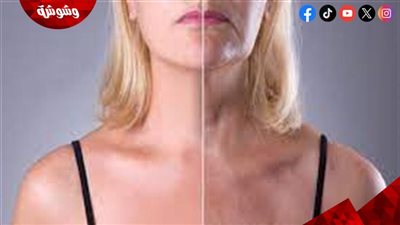 أسباب ظهور التجاعيد على صدرك
