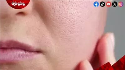 بعض النصائح للتخلص من المسام الواسعة في البشرة 