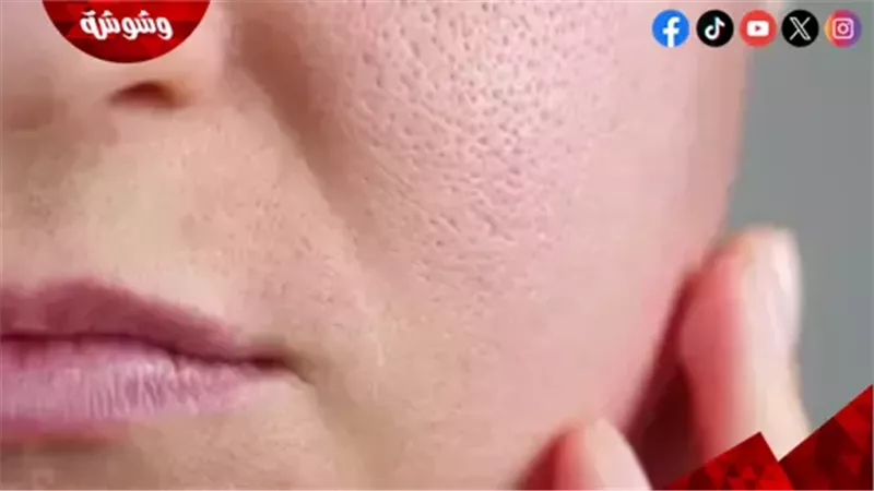 المسام الواسعة في
