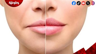 أنواع عمليات نفخ الشفايف ومخاطرها بقلم آلاء حسين