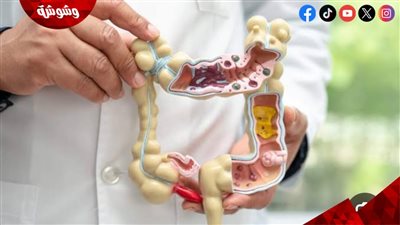 بهذه الأكلات.. طريقة مضمونة لتنظيف القولون من السموم 