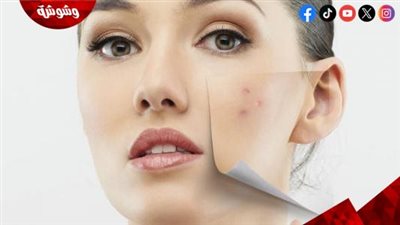 5 علامات واضحة لنقص الفيتامينات والمعادن