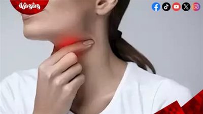 عصير الليمون أم العسل.. أيهما أفضل لعلاج التهاب الحلق؟ 