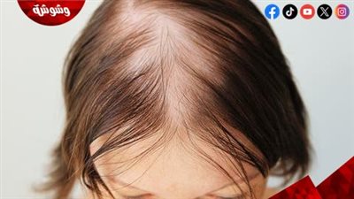 خطوات استخدام زيت الروز ماري لاستعادة جمال شعرك