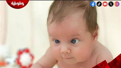 تعرفِ على أسباب حول العينين عند الأطفال