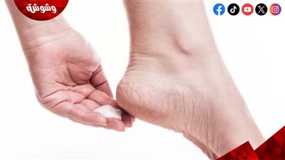 تزداد بفصل الشتاء.. تعرف على أسباب تشققات القدم