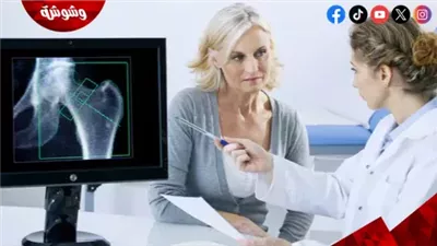 استشاري التغذية العلاجية: النساء عرضة للإصابة بهشاشة العظام‎