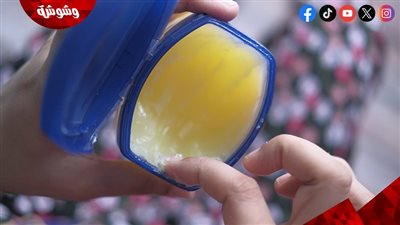 لتجنب ظهور الحبوب.. تعرف على الطريقة الصحيحة لاستخدام الفازلين الطبي