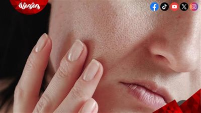وشك هينور.. تعرفِِ على طرق العناية بالبشرة الجافة في الشتاء