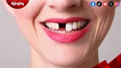 ما علاقة فقدان الأسنان بخطر الإصابة بالخرف؟