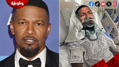 جيمي فوكس يكشف التفاصيل المؤلمة لقصّة نجاته من الموت (فيديو) 