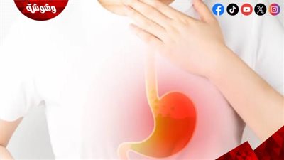  أسباب وطرق علاج ارتجاع المريء والحموضة.. طبيب يوضح