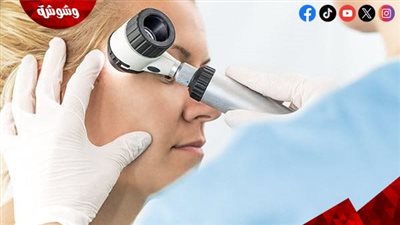 ليس لإزالة الشعر فقط.. تعرف على كيفية علاج الأمراض الجلدية بالليزر
