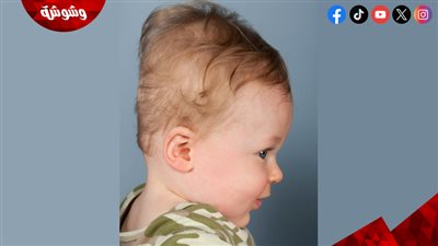لماذا يتغير شكل رأس الرضيع بعد الولادة؟.. اعرف الأسباب