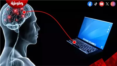 خبير أمن معلومات يكشف مفاجآت عن شريحة إيلون ماسك الدماغية