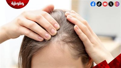 3 تسريحات تُسبب تساقط الشعر.. احذريها