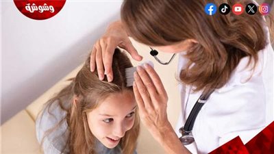 طرق علاج تساقط الشعر عند الأطفال