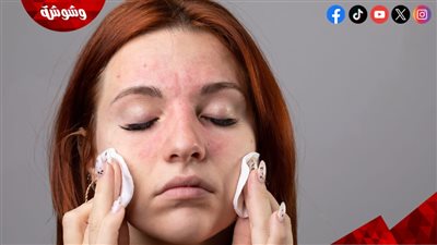 لا تهمليها.. خطوات العناية بالبشرة بعد العيد 
