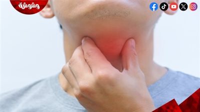 4 أنواع من الشاي لعلاج التهاب الحلق