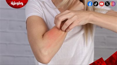 تأثير التوتر النفسي على صحة الجلد عند النساء