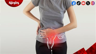 احذريها.. 5 علامات قد تشير إلى إصابتك بمرض بطانة الرحم