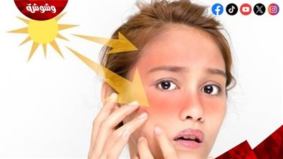 بمكونات طبيعية.. طريقة عمل واقي شمس في المنزل