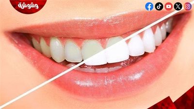 قبل العيد.. حل فعال لتبييض الأسنان في دقيقتين