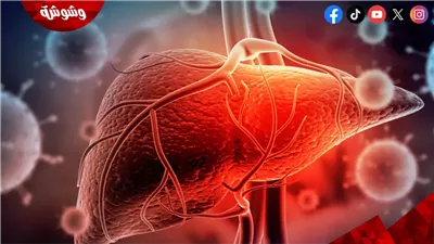 الصحة: مصر تحقق إنجازًا عالميًا في السيطرة على التهاب الكبد 