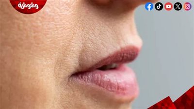 أسباب الاسمرار حول الفم 