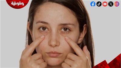 الحل السحري للهالات السوداء موجود في بيتك.. جربي زيت الخروع وسترين الفرق