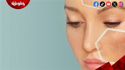 بشرتك مرآة صحتك.. علامات خطيرة لا تتجاهليها  