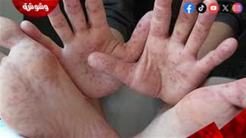 صورة توضيحية