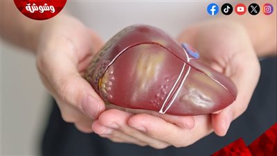 دليلك الغذائي لصحة الكبد.. أطعمة تحميه وأخرى تضرّه  