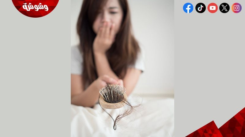 تساقط الشعر