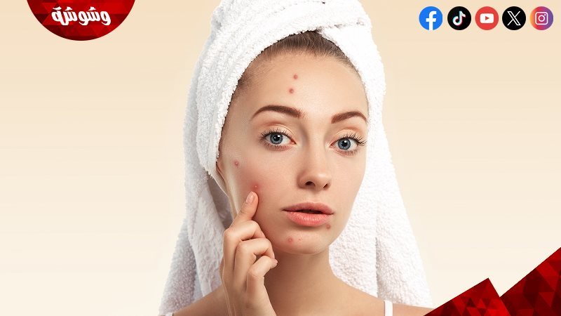 ماسك لرؤوس السوداء