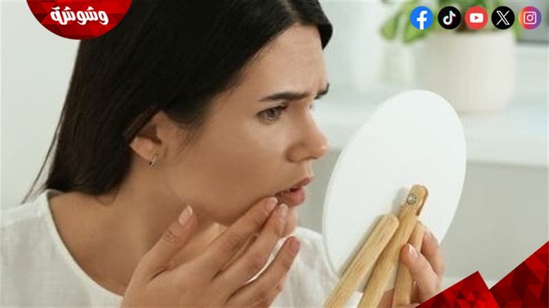 تغيرات هرمونية