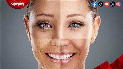 هل يناسب زيت الجوجوبا البشرة المختلطة؟.. تفاصيل 