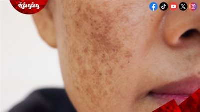 أفضل روتين ليلي لمكافحة التجاعيد والبقع الداكنة
