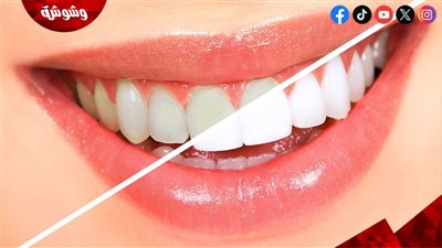 طرق طبيعية لتبييض الأسنان.. حلول آمنة تمنحك ابتسامة أكثر إشراقًا