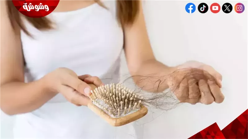 تساقط الشعر 